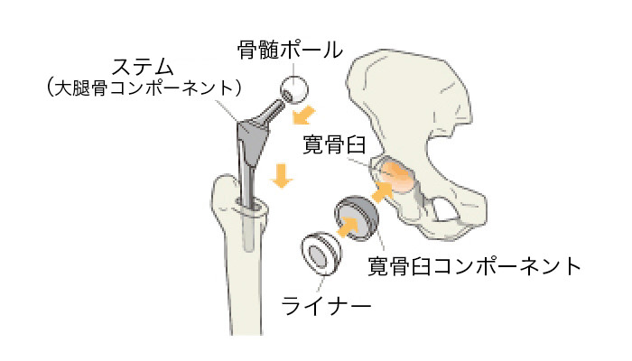 イメージ図
