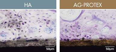 Figure：HA, AG-PROTEX