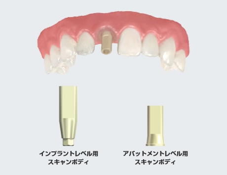 インプラントレベル用スキャンボディ アバットメントレベル用スキャンボディ